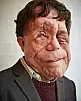 Adam Pearson Fotoğrafı