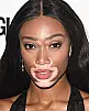 Winnie Harlow Fotoğrafı